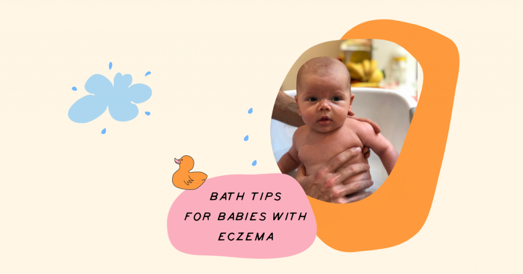 Bath tips for babies with eczema